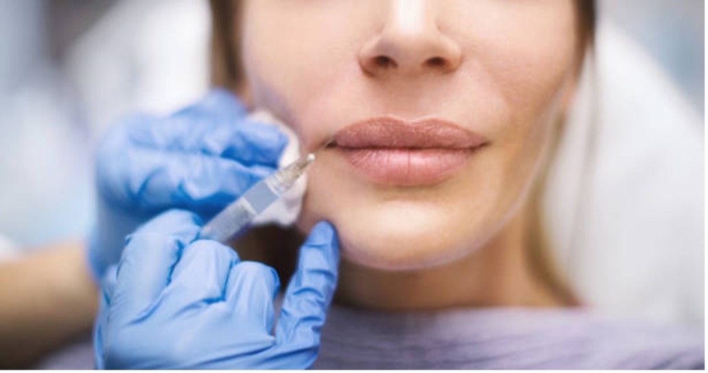 Relleno Labios