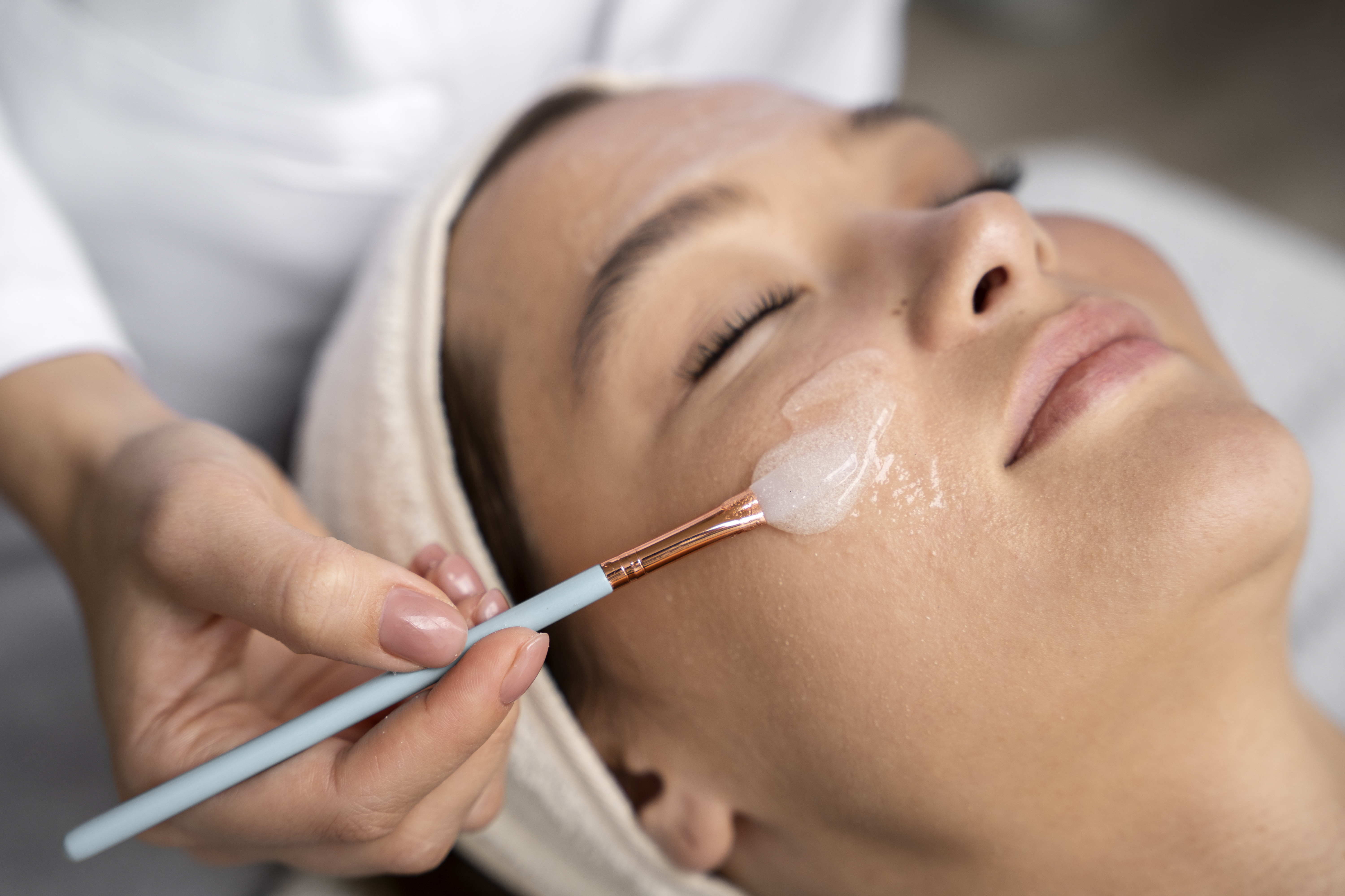 Peeling Químico