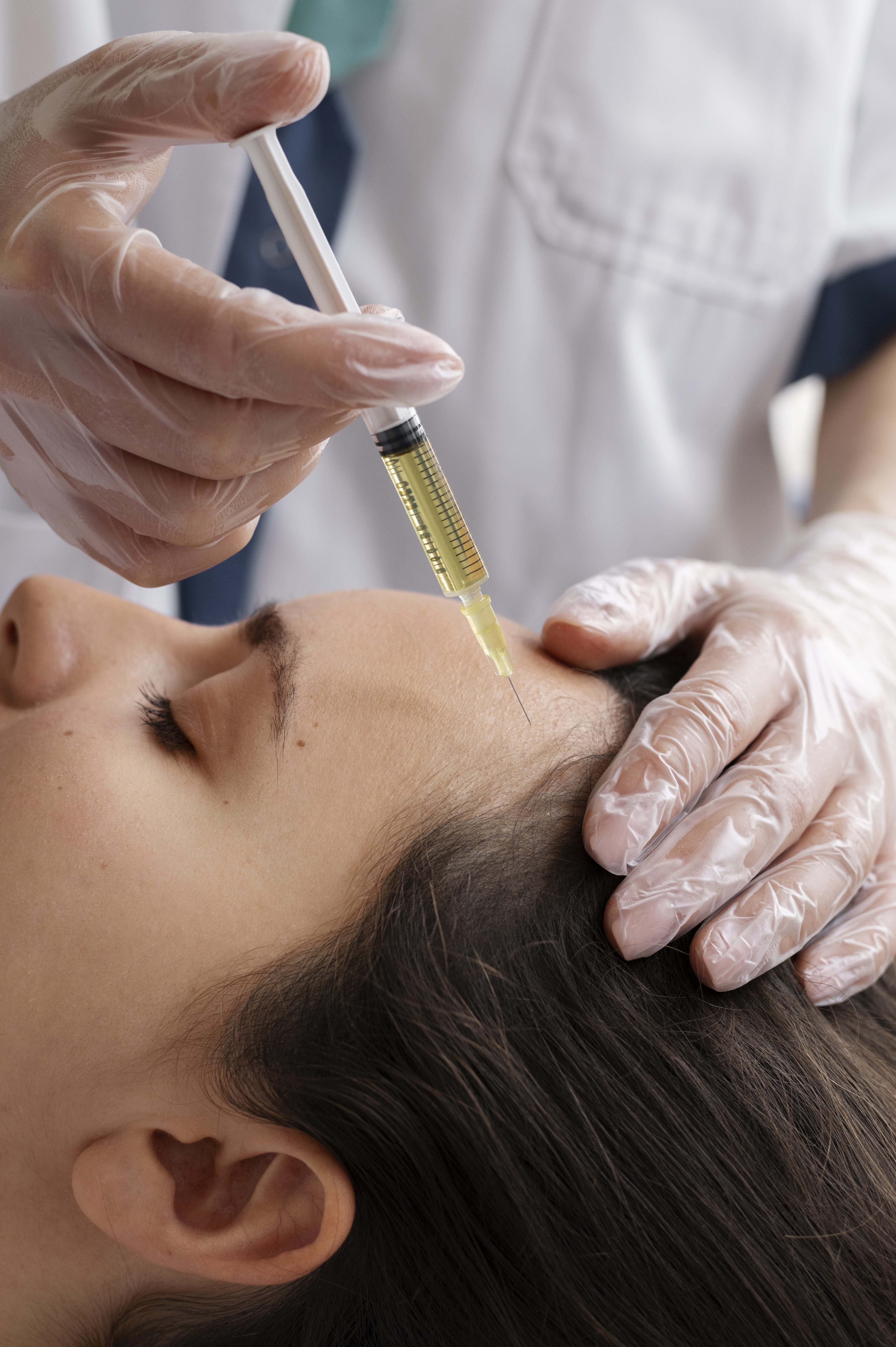 PRP Facial, Cuello y Capilar